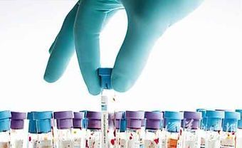 親子鑒定應(yīng)具備的條件